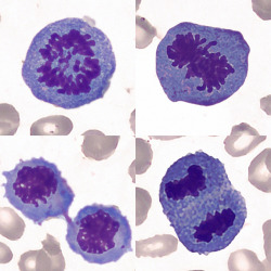 Mitosefiguren